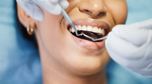 Best Emergency Dentist for Knocked-Out Tooth in Akron, CO